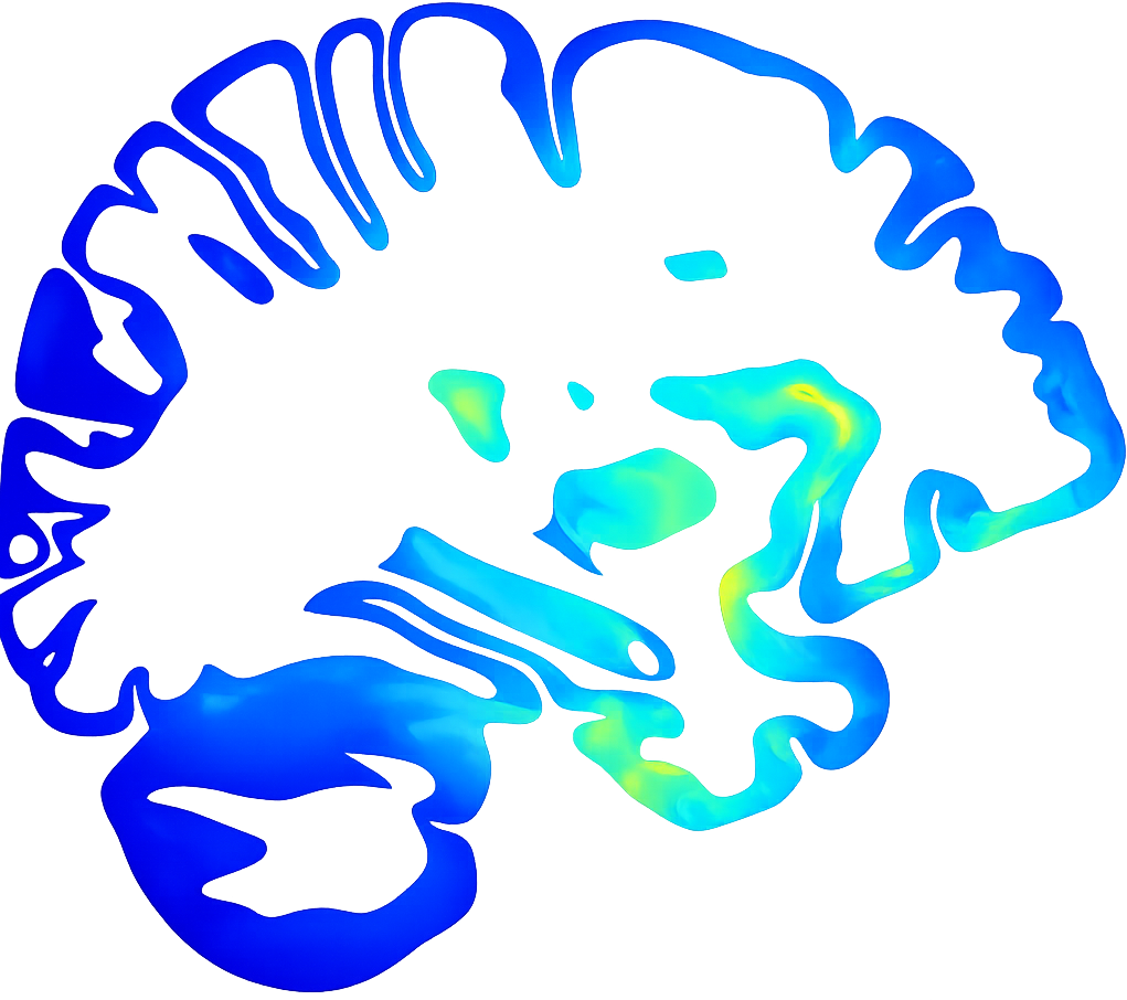 Electric-field modeling of OAK stimulation in the brain